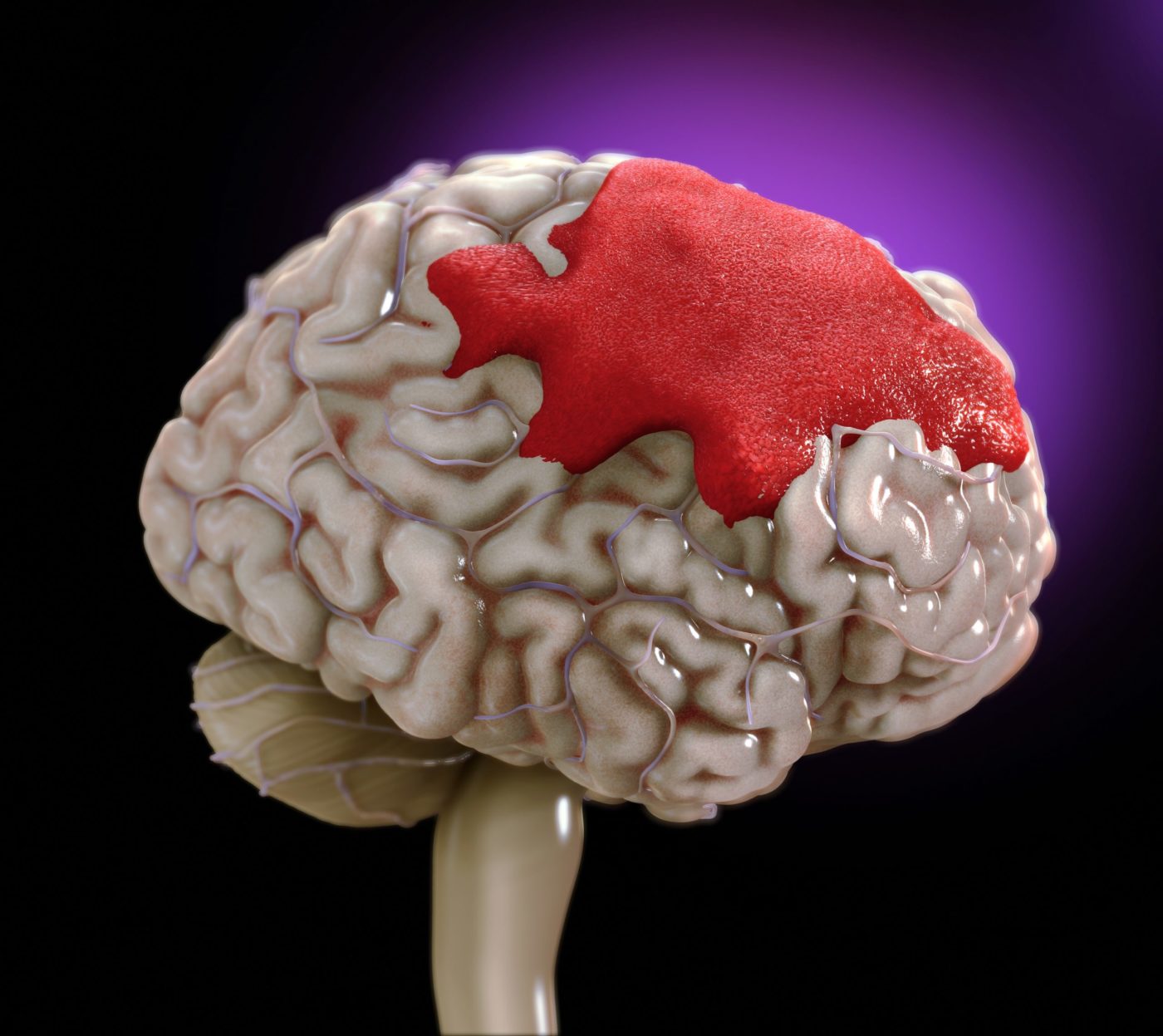 Advanced Neurological Mapping