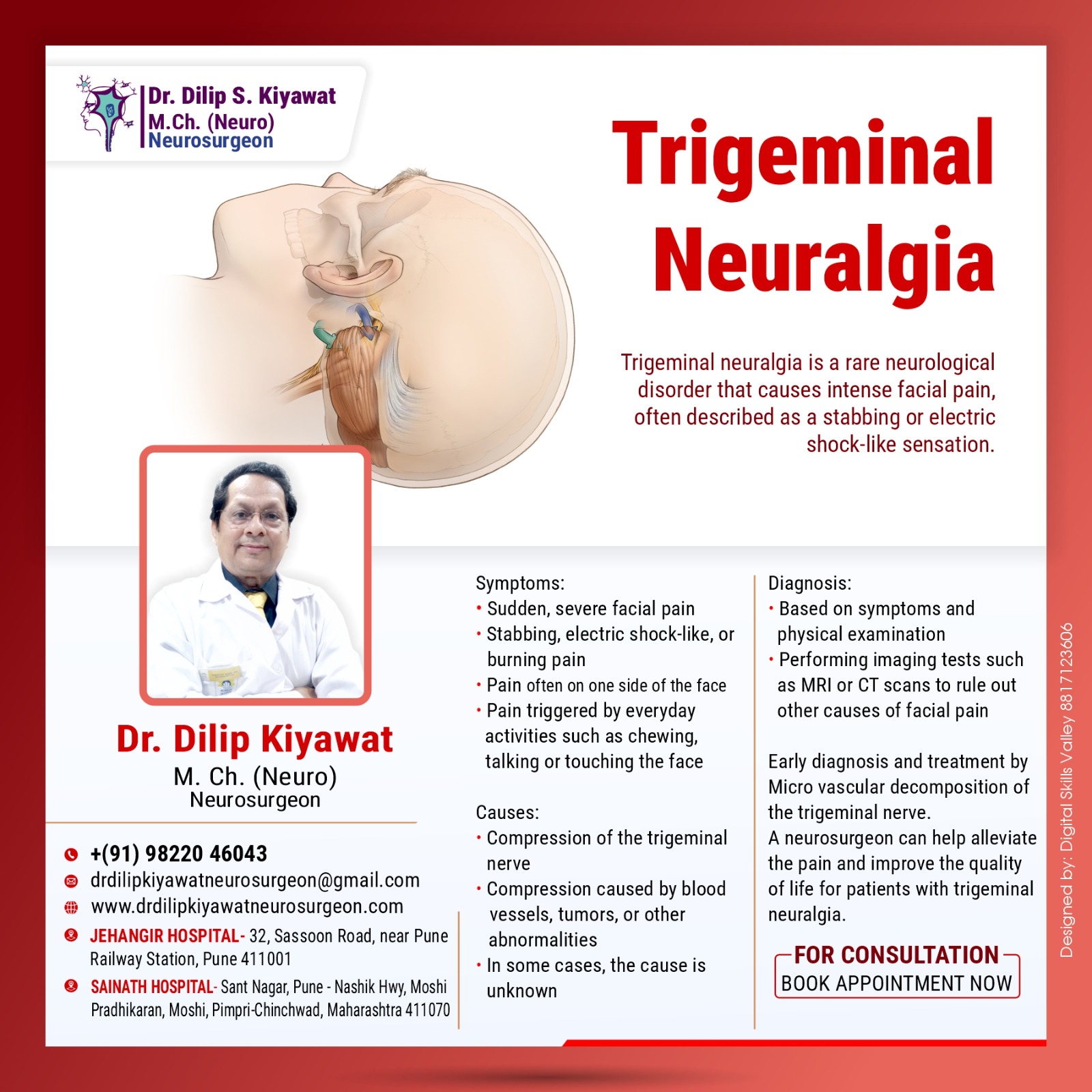 Trigeminal Neuralgia Causes & MVD