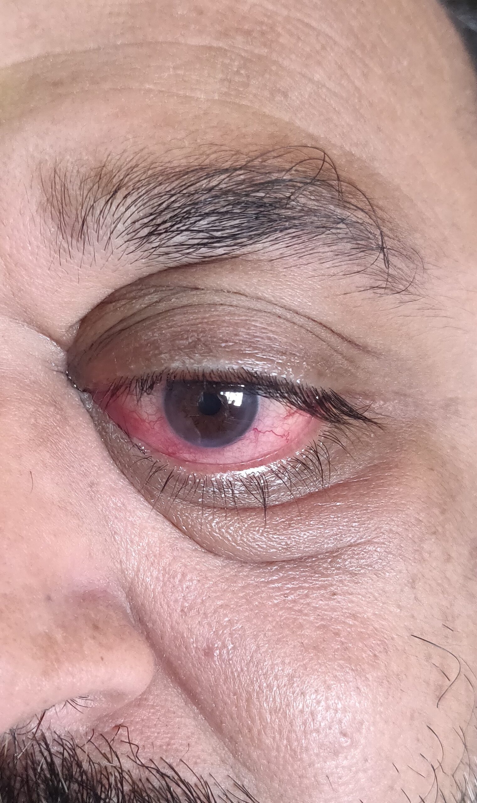 Neuro-Ophthalmic Examination