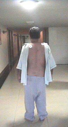Four hours after lumbar disc surgery